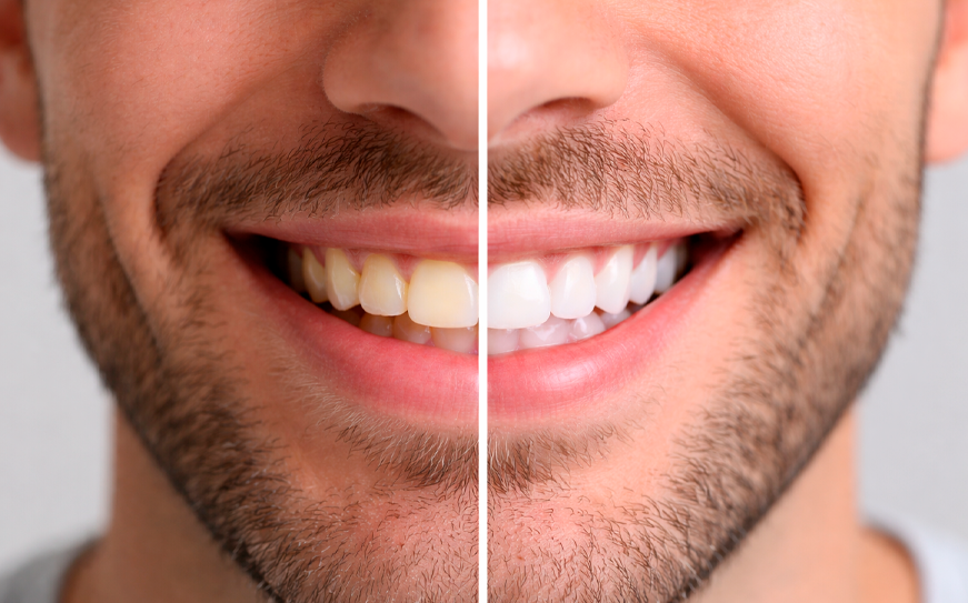 Vista de servicios dentales 3